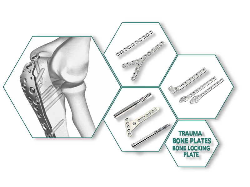 Trauma Implants